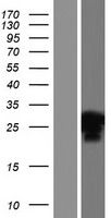 INO80C Human Over-expression Lysate
