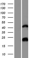 HCG1657980 (LOC200726) Human Over-expression Lysate