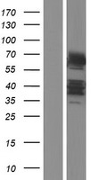 DTX2 Human Over-expression Lysate