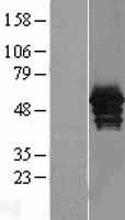 Annexin A11 (ANXA11) Human Over-expression Lysate