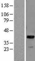 ARG2 Human Over-expression Lysate
