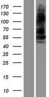 BMPR1B Human Over-expression Lysate