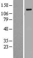 BubR1 (BUB1B) Human Over-expression Lysate