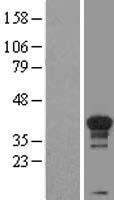 Cyclin H (CCNH) Human Over-expression Lysate