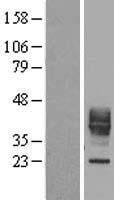 CD153 (TNFSF8) Human Over-expression Lysate