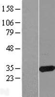 CBR3 Human Over-expression Lysate