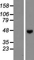 ENTPD5 Human Over-expression Lysate