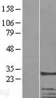 CKAP1 (TBCB) Human Over-expression Lysate