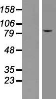 CLC7 (CLCN7) Human Over-expression Lysate