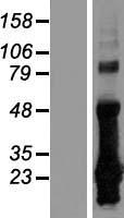 CRIP2 Human Over-expression Lysate