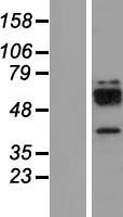 Cathepsin W (CTSW) Human Over-expression Lysate