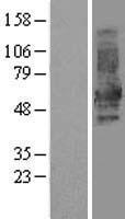 DOK1 Human Over-expression Lysate