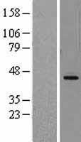 DHODH Human Over-expression Lysate