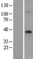 DHCR7 Human Over-expression Lysate