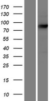 ECE1 Human Over-expression Lysate