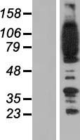 FYB1 Human Over-expression Lysate