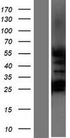 GCNF (NR6A1) Human Over-expression Lysate