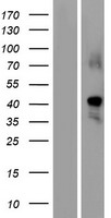 GDF1 Human Over-expression Lysate