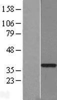 GTF2H3 Human Over-expression Lysate