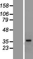 MR1 Human Over-expression Lysate