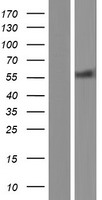 HDAC2 Human Over-expression Lysate
