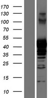PRMT1 Human Over-expression Lysate