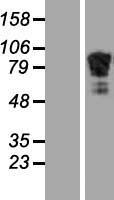 Adducin 2 (ADD2) Human Over-expression Lysate