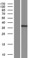 AKR1B1 Human Over-expression Lysate