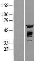 AKT2 Human Over-expression Lysate