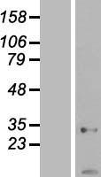 AK2 Human Over-expression Lysate