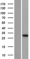 AUH Human Over-expression Lysate