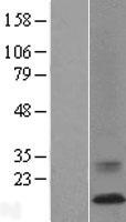 ATP6V0C Human Over-expression Lysate
