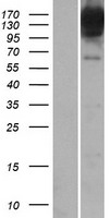 BICD1 Human Over-expression Lysate