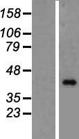 BMP8B Human Over-expression Lysate