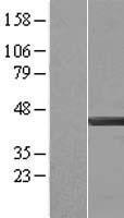 Actin Regulatory Protein CAPG (CAPG) Human Over-expression Lysate