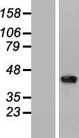 CD1B Human Over-expression Lysate