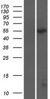 CCT6A Human Over-expression Lysate