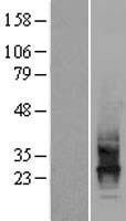 CD63 Human Over-expression Lysate