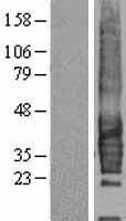 CD37 Human Over-expression Lysate