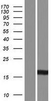 CDA Human Over-expression Lysate