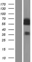 CDC25A Human Over-expression Lysate