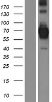 CENPB Human Over-expression Lysate