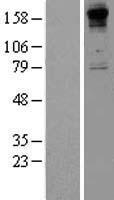 COL8A1 Human Over-expression Lysate