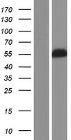 Carboxypeptidase H (CPE) Human Over-expression Lysate