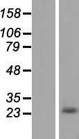 Casein (CSN1S1) Human Over-expression Lysate