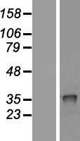 CRHBP Human Over-expression Lysate