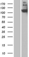 CD21 (CR2) Human Over-expression Lysate