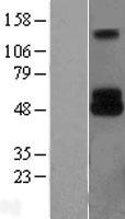 TRP2 (DCT) Human Over-expression Lysate