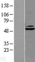 DBT Human Over-expression Lysate