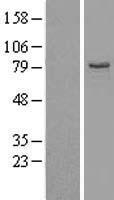 EHHADH Human Over-expression Lysate